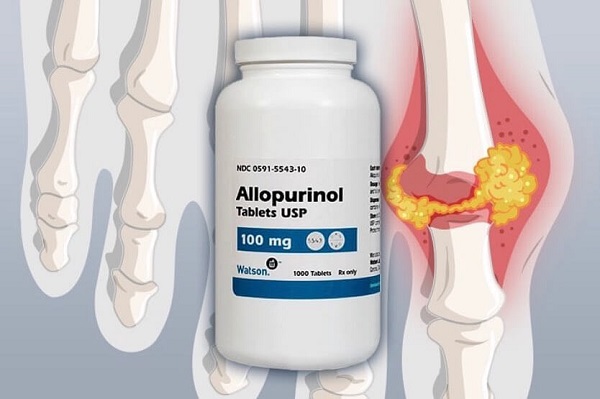 Allopurinol - Nhóm thuốc giảm tổng hợp acid uric