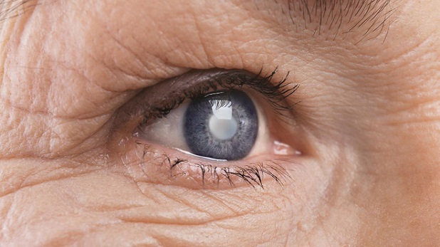 Bệnh lý ở mắt khi bị tiểu đường