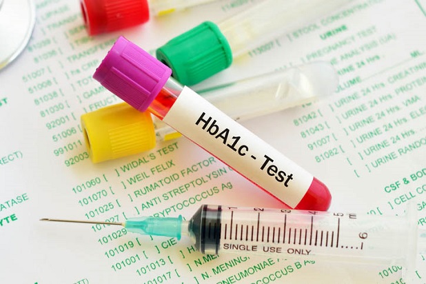 HbA1c là chỉ số xét nghiệm lượng đường trong máu