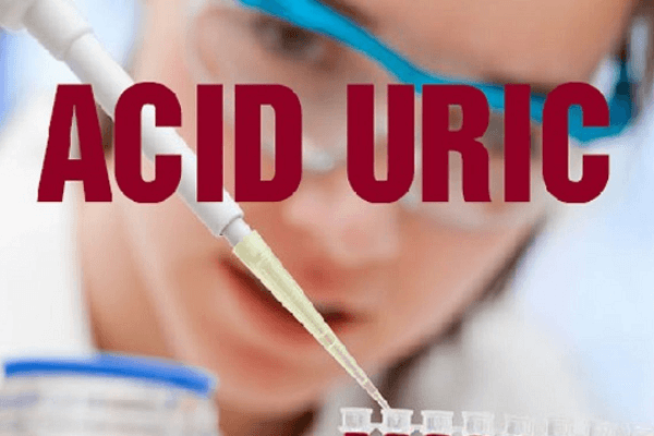 Ảnh: Định lượng acid uric niệu