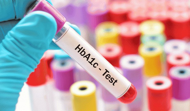 Xét nghiệm HbA1c để kiểm tra mức độ bệnh tiểu đường